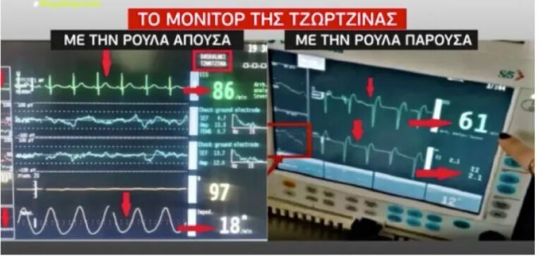 Τι έδειχνε το μόνιτορ της άτυχης Τζωρτζίνας όσο ήταν παρούσα η Πισπιρίγκου;