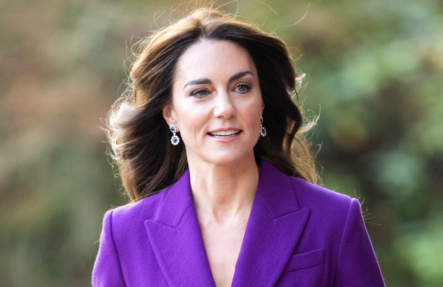 Αισιοδοξία για τη Kate Middleton  – Ο οργανισμός της ανταποκρίνεται στη θεραπεία